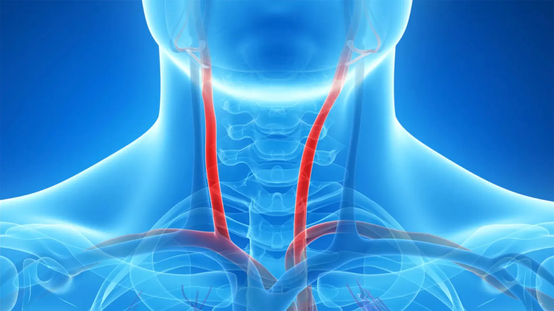 carotid-endarterectomy-surgery-gold-coast-vascular-gc